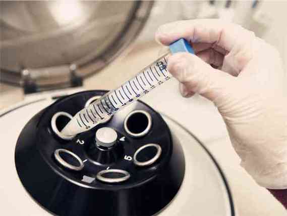 供卵试管代怀多少费用_供卵试管代怀费用查询及解析