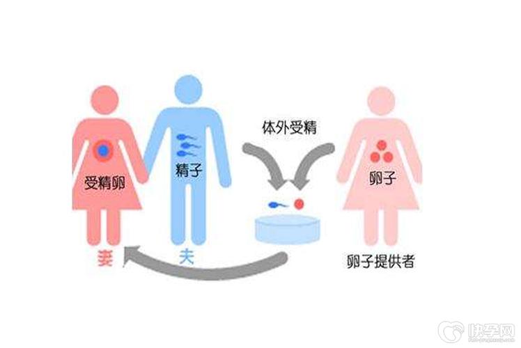 供卵生子流程_供卵生子流程:一窥生殖医学的奇妙世界